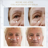 Collagen Boost Eye Serum